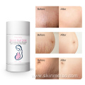 Pregnancy Removal Scars Prevention Stretch Cream Stick